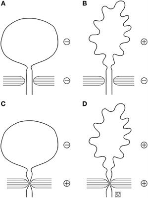 Surgical Management of Neurogenic Sphincter Incompetence in Children